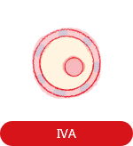 IVA（原始卵胞体外活性化法）